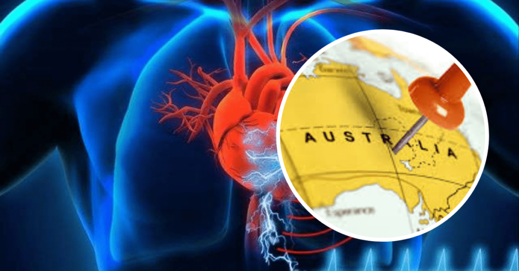 AUSTRALIA-TGA-propone-riclassificazione-dei-dispositivi-medici-impiantabili-attivi-e-relativi-accessori-1024×536